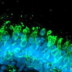 Axol Bioscience acquires ophthalmology business from Newcells Biotech