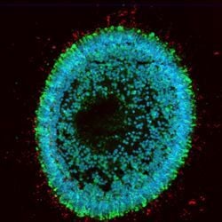 New eBook Physiologically relevant in vitro retinal models for ophthalmology drug discovery and safety testing