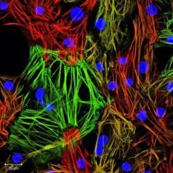 iPSC-derived cardiomyocytes for drug discovery, research and cardiotoxicity studies (1)
